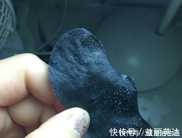 洗面奶|先别慌着挤黑头,这3种原因你知道了再挤也不迟!