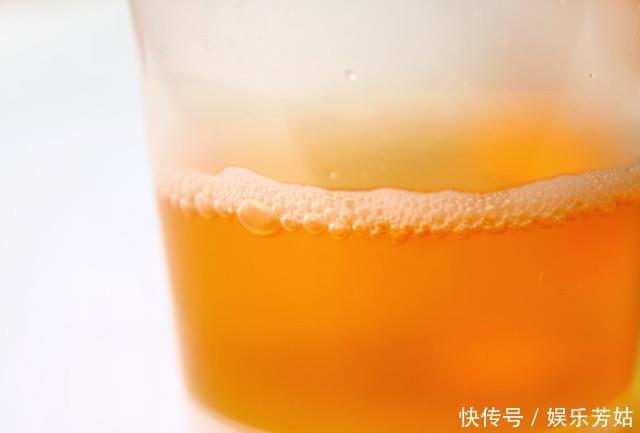 这4个部位出现异常，或许是肝脏受损了，建议查一下肝功能！