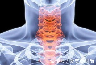 運動神經元病|漸凍人和頸椎病有關系嗎？