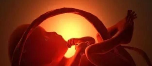 脐带绕颈|孕妈身体有这个“感觉”,别认为是好事,可能是宝宝“脐带绕颈”