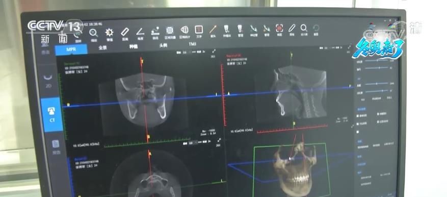 北京冬奥医疗保障团队通过移动和远程诊疗设备 保障赛时高效救治|燃情冰雪 拼出未来 | 救治