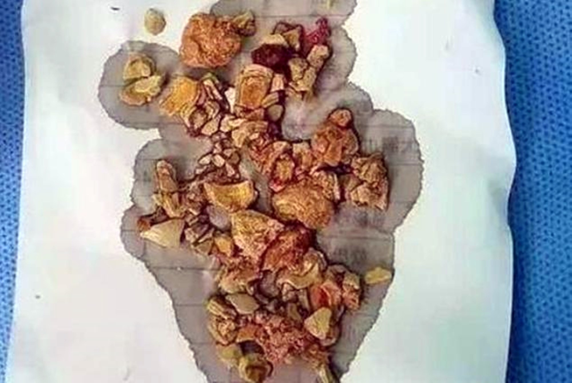 汤泡饭|宝妈的这种“偷懒辅食”,看似喂饱孩子实则没营养,还会造成积食