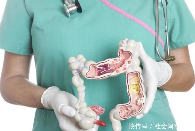 冬至清肠正当时,隔三差五吃,便秘没了,排出毒素,体重降得快