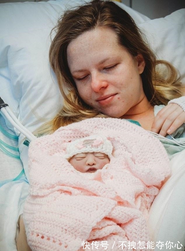 无脑|70分钟的母爱!美国年轻夫妇执意生下无脑儿,去世后捐出全部母乳