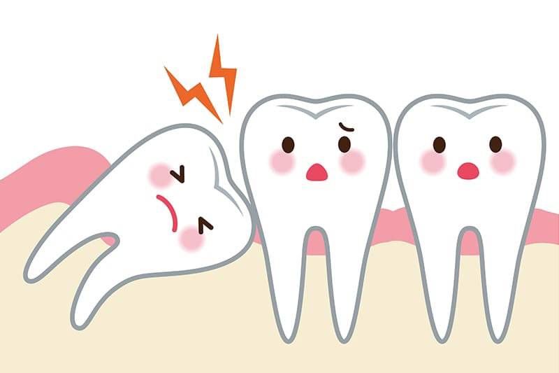 健康正前方｜拔智齿能瘦脸？别做梦了！