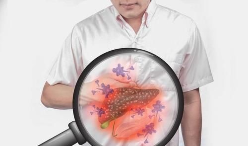 治疗|晚期癌症，该不该做化疗？患者可能会“尝到”3个好处