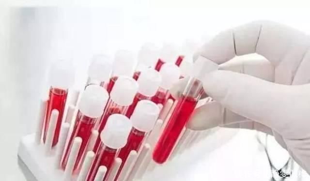 高血脂真正敌人并非肥肉,该忌口了,别等血管堵塞,脑梗来才后悔