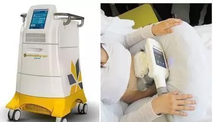 皮下组织 酷塑和吸脂哪个好酷塑术后注意事项有哪些