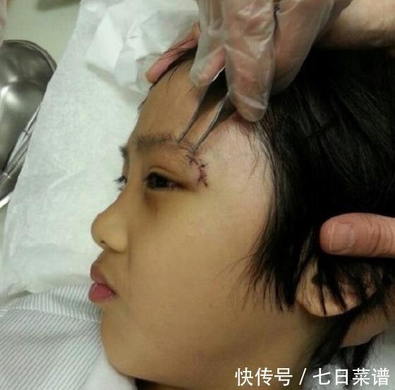 “抵制日漫”費(fèi)曼:參加爸哪左眼永久受損,其父吳鎮(zhèn)宇后悔上節(jié)目