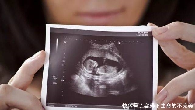 四维彩超|为什么我的四维彩超图像没有别人的清晰？