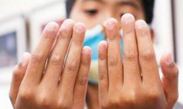 指甲|孩子爱啃手指甲是病时间长了得抑郁症家长别再犯傻不注意