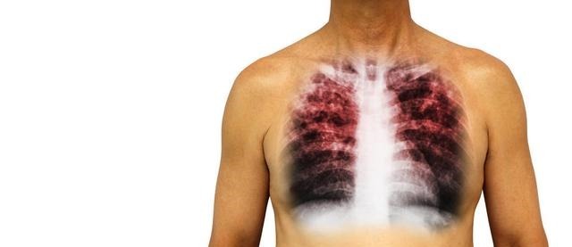 经络|中医谈疼、痛、痒、酸、胀、麻、疲、乏、饥、饿、劳、累、聪