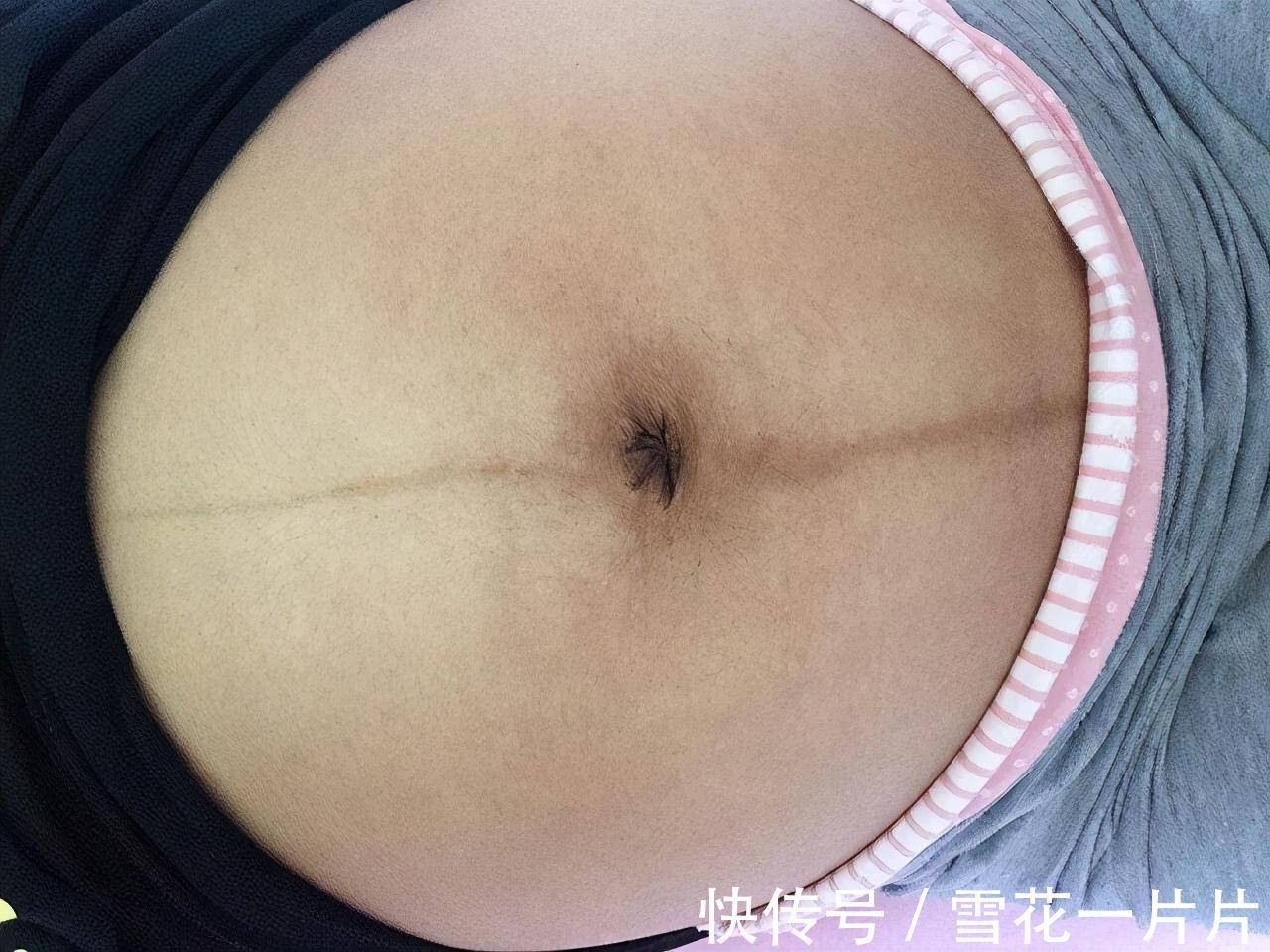 肚脐眼|怀的是男孩还是女孩，看孕妈肚脐“凹凸”就知道？科学解释在这里