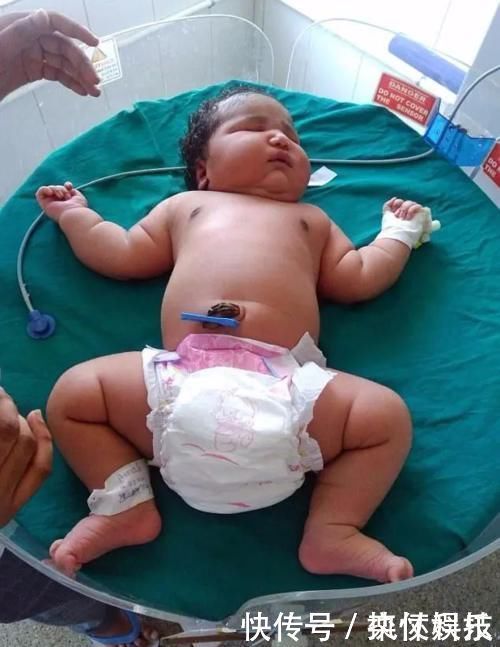 新生儿|19岁女孩生下13.6斤巨婴 原因让人瞠目结舌