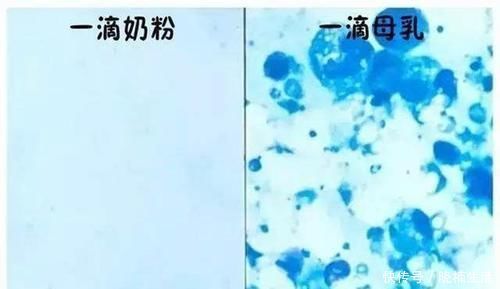 孩子|母乳被放大1000倍，在显微镜下“活了”，纯净程度不一般