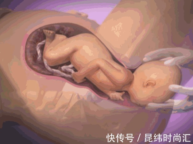 分娩|胎儿分娩前在忙什么?忙着收拾东西出来呢,过来人的说法很真实