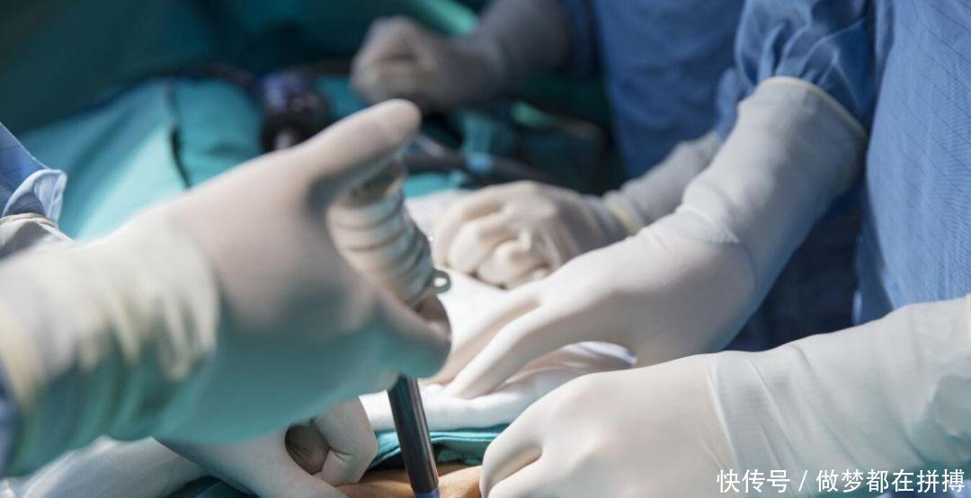 邵逸夫|32岁工程师查出胰腺癌! 手术太难没人敢接, 绝望之际他用一招救了自己!