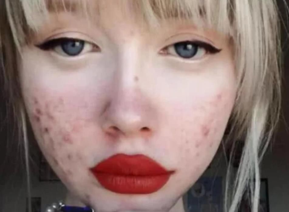 青春期最“糟蹋颜值”的3行为,05后别再盲目跟风,变丑可别哭鼻子