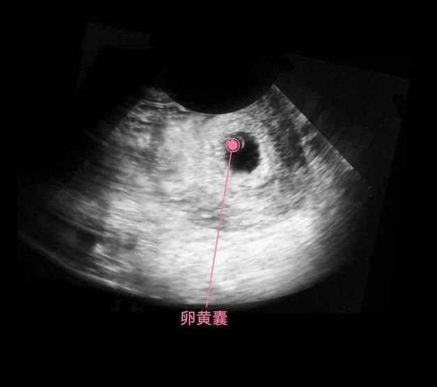 性别|胎儿从卵泡到性别形成,17张图片清晰诠释,男宝女宝看得很清楚