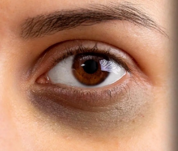 熬夜 经常熬夜该如何拯救“崩掉”的颜值?4大医美黑科技来了~