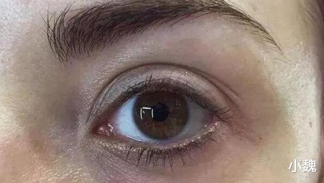 列入|世卫组织3种蔬菜已被列入伤肝“黑名单”,提醒父母,尽量少吃