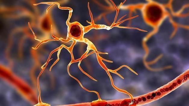 血管堵塞|食物“溶栓剂”公布了，早晚敞开吃，疏通血管，血栓或退避三舍