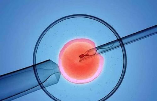 寿命|试管婴儿和普通婴儿,有什么区别并非寿命和智商,差的只有这个