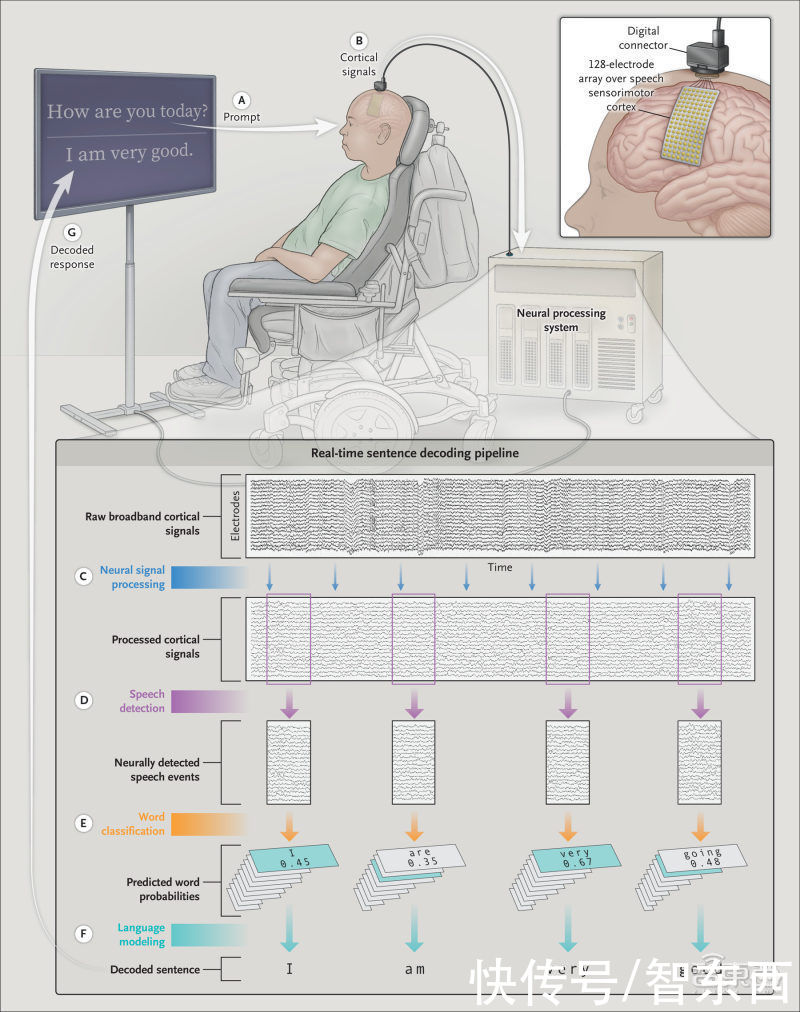 脑机|让失语者能“说话”！脑机接口新进展：首次从大脑活动解码完整单词