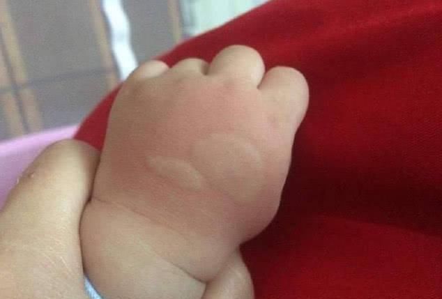 麻烦|小蚊虫大麻烦，宝宝眼睛都肿了，驱蚊止痒，妈妈只用8个小妙招