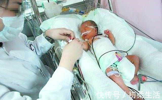 脐带|新生儿患上败血症,只因妈妈这个小动作,网友怎么狠心下得了手