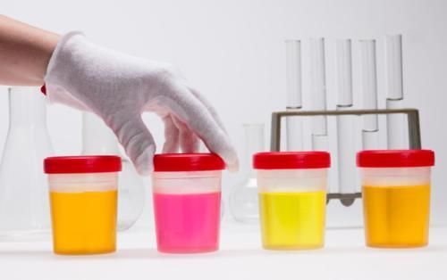 老大哥|65岁男士无痛血尿就诊,医生庆幸:警惕性高,及时发现了早期癌症