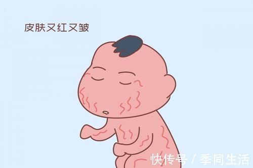 孩子|宝宝刚出生时,这3个部分越丑,长大越容易变漂亮,家长可别嫌弃
