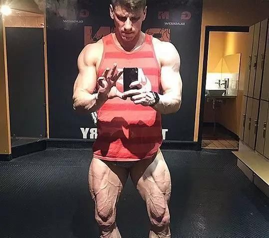 大重量|26岁健美冠军,小腿突发意外,体脂太低是“原罪”