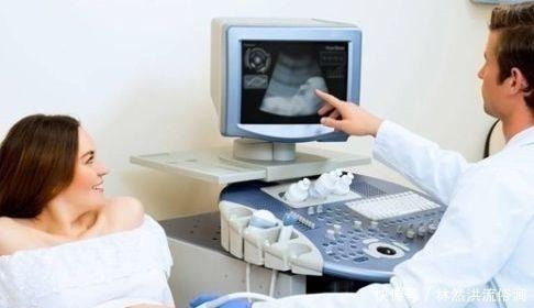 四维彩超|四维检查时,小家伙竟然在孕妈腹中干“坏事”,医生都被逗笑了