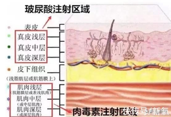 间隔期|为什么她会从整形模板翻车成馒化代表？