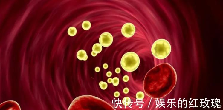 医生|喝牛奶会导致血脂升高？医生：若想甘油三酯稳定，建议少碰这3物