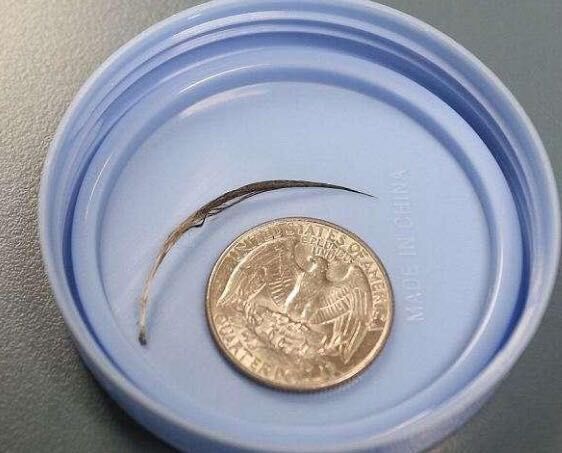 小琴|2岁宝宝哭喊挠脖子,去医院取出东西后,一家人情绪失控