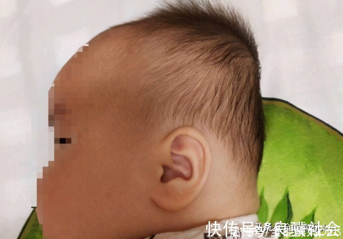 圆头|“妈求求你,别给我睡扁头了”扁头有多毁娃?3张对比图告诉你