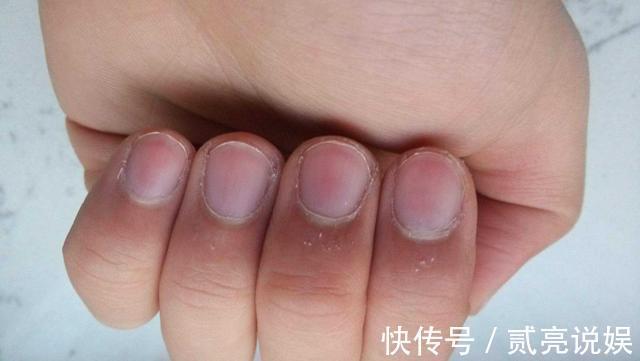 阳气不足|指甲上的“月牙”越多越好有些人可能搞错了,最好了解一下