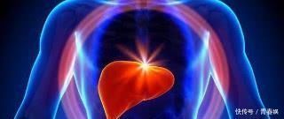 柑橘|别嫌它丑, 却是肝脏“保护神”, 每天吃点, 排毒养肝, 肝病不来扰