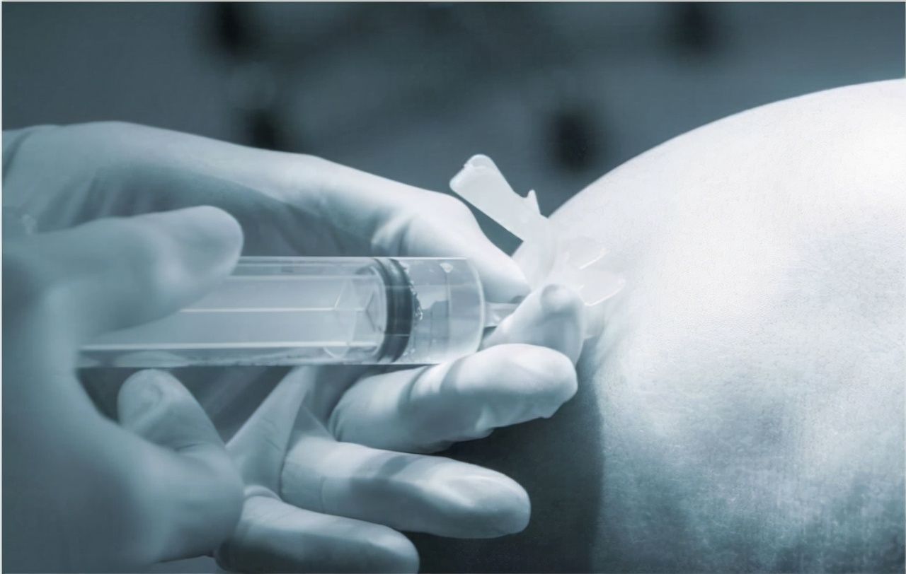 一文|有备无患,一文了解麻醉的那些事儿