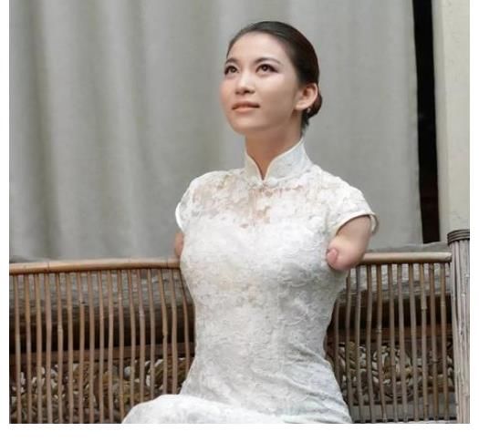 女孩|《非诚勿扰》无臂女孩台上牵手，台下惨遭抛弃，如今怎么样了？