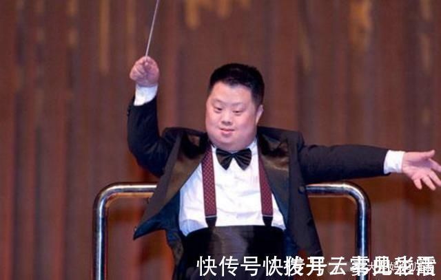 新生儿|有“唐氏综合征”的孩子，面部是什么样子？婴儿期能看出来吗