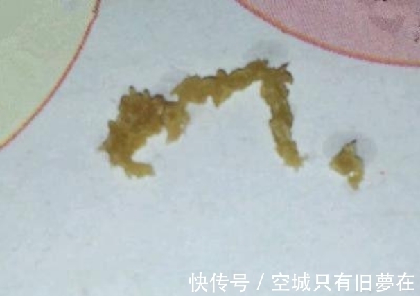 异物|男孩耳朵有异物，去医院检查后，医生一句话让母亲羞愧难堪