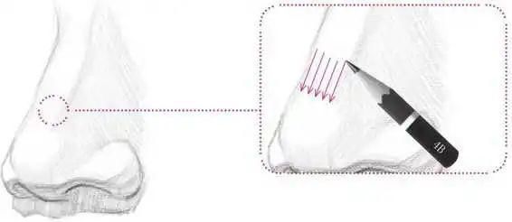 鼻孔@零基础素描教程:分步骤讲解34侧面鼻子画法,简单易学,快临摹