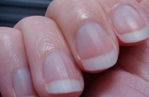 手指|手上出现这9个表现，可能是体内疾病发出的求救信号，别不当回事！