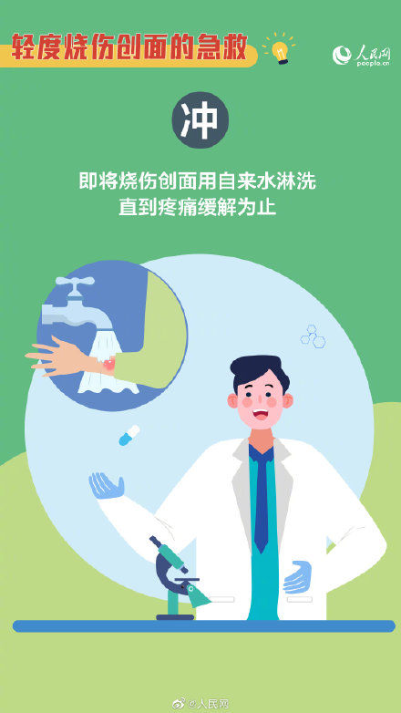 急救|“冲、脱、泡、盖、送” 烧伤急救5字诀请记牢！