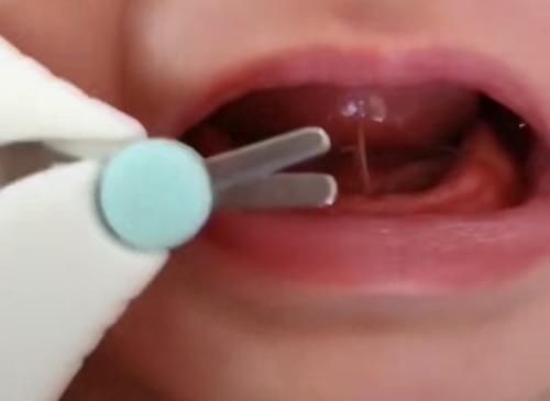 老一辈认为宝宝没剪舌根,将来说话会不利索?信了你就坑娃于无形