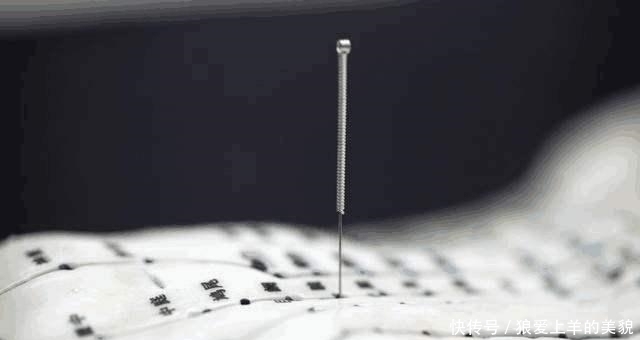 不疼|一步到位的方子治脚后跟疼、脚后跟骨刺,再现中医合理性