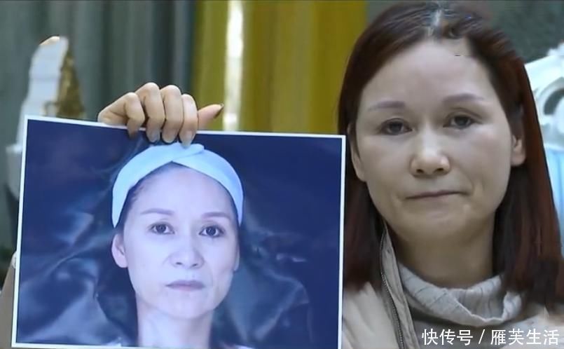 女子整容花13万效果不理想要求退款 医院：50岁不可能做成18岁